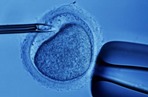 In Vitro Fertilization