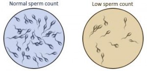 Post Vasectomy Reversal Semen Check